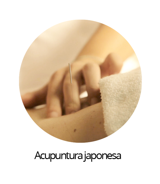 SERVICOS-Acupuntura japonesa_.png
